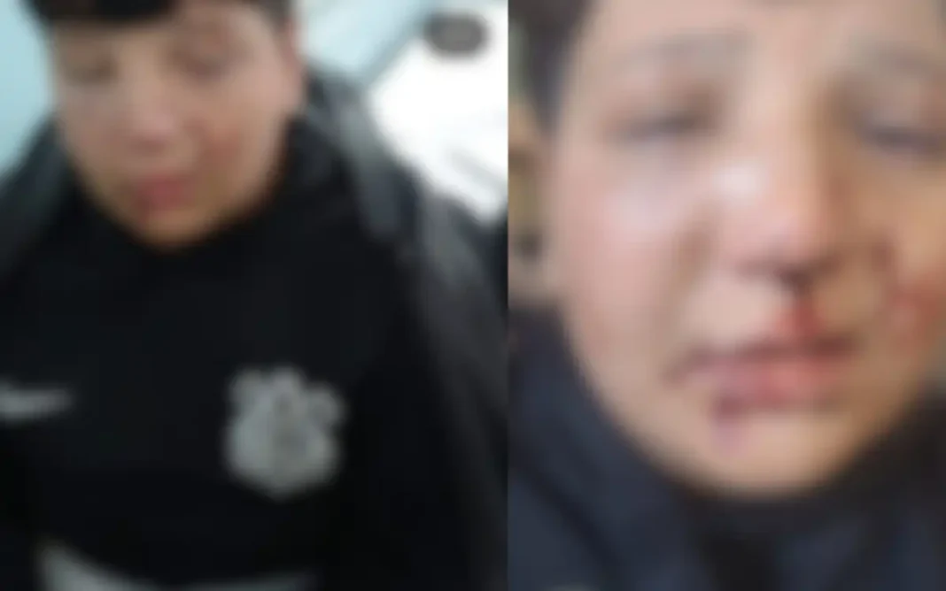 Aluno de 12 anos é brutalmente agredido dentro de escola em Atibaia