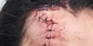 Mulher sofre corte na testa após agressão e companheiro é preso por violência doméstica