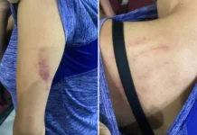 Criança de 6 anos com deficiência auditiva e mãe são agredidas em residência