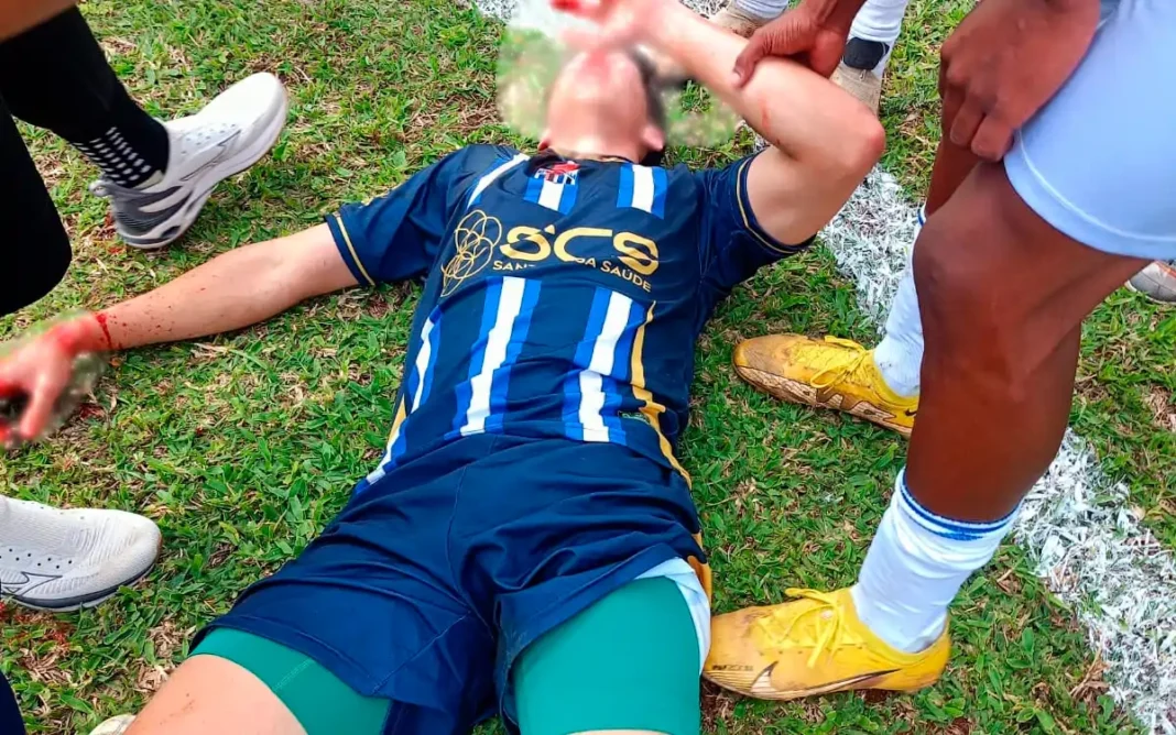 Jogador do Sparta Villa sofre agressão durante partida do Campeonato Amador e segue internado
