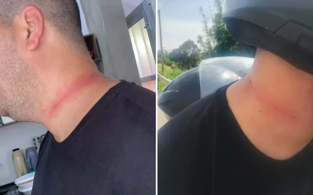 MOTOCICLISTA É ATINGIDO POR LINHA CHILENA E QUASE SOFRE GRAVE ACIDENTE