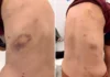 Mulher sofre fraturas após agressão e homem é detido em flagrante em Bragança Paulista
