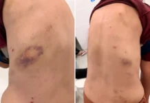 Mulher sofre fraturas após agressão e homem é detido em flagrante em Bragança Paulista